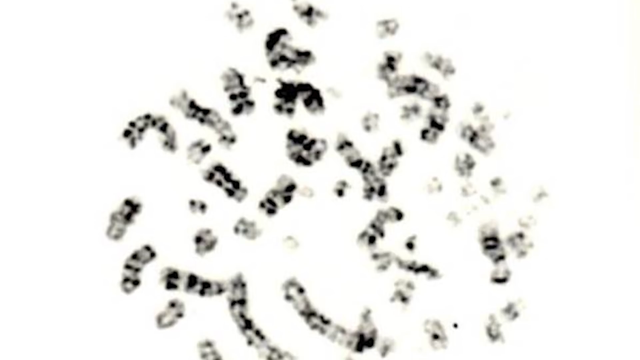 大内久83天活体腐烂图片，大内久83天活体腐烂是什么（大内久与核辐射战斗了83天）