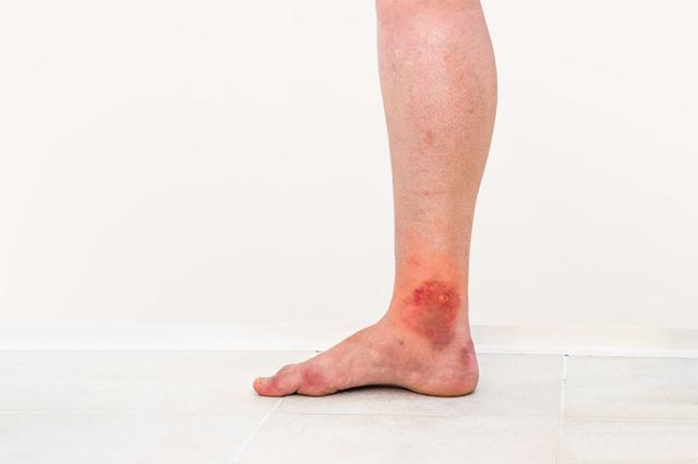 虱子相关介绍，虱子怎么读（30年前男女老少都长虱子）