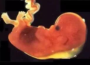 胎儿畸形最早什么时候可以查出来，几个月可以查胎儿畸形（胎儿最早什么时候能查出“发育不良”）