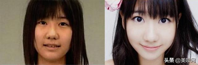 霓虹女星变脸史：菜菜绪换头、森绘梨佳像发面馒头！她最成功