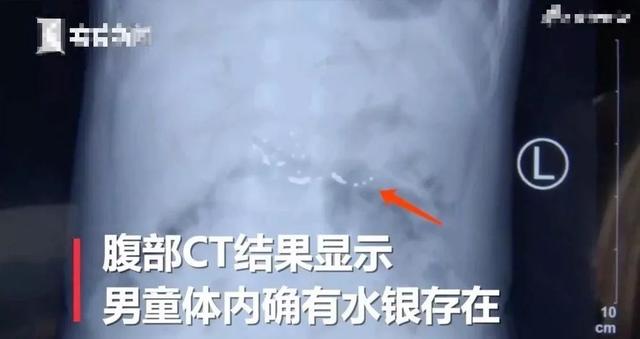 家里水银掉地上怎么处理干净，水银洒在地上怎么清理（妈妈的举动让全家中毒）