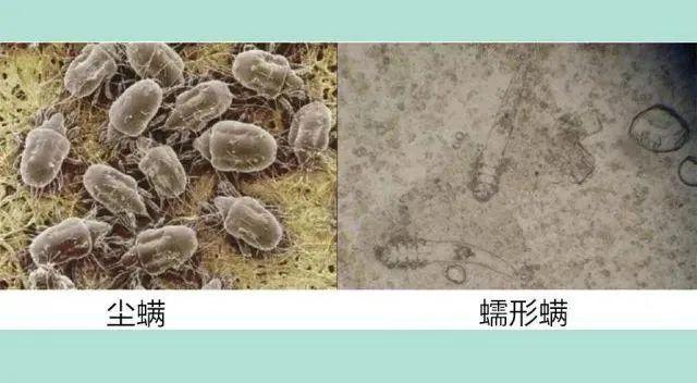 除螨皂一天用几次，除螨皂一天用几次最好（冬天是螨虫的“活跃”期）