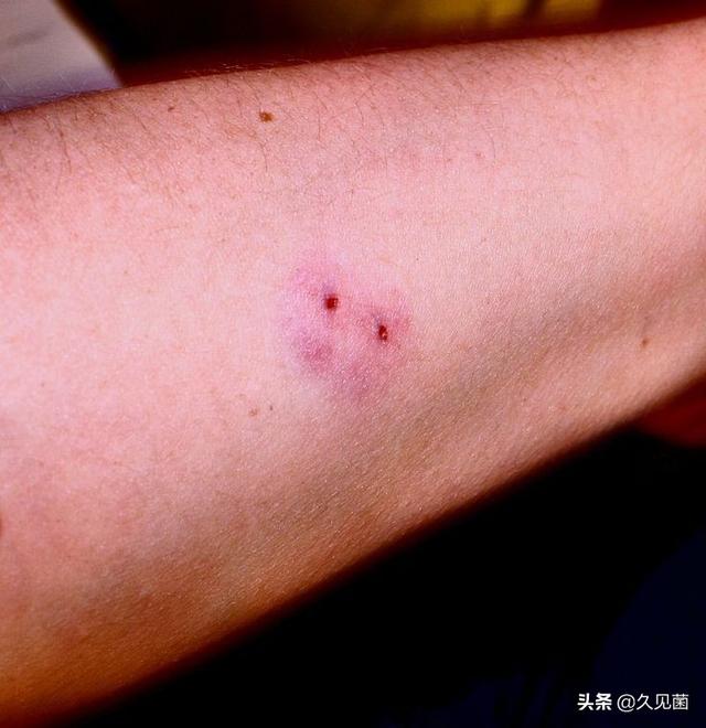 印度蛇为什么是保护动物，印度每年4.59万人死于蛇咬