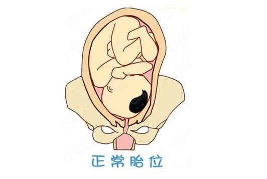胎位指的是胎儿在子宫里以什么样的姿势和位置待着.