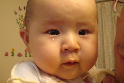 巩膜黄染早期图片，黄染是什么病（孩子刚出生下来就“中了”黄疸）