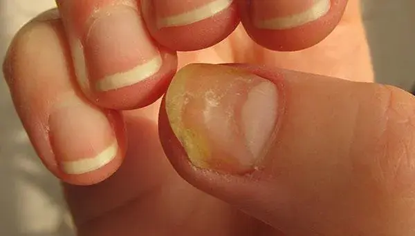 手指上的月牙白代表什么，手指没有月牙是肾虚吗（指甲上的月牙代表什么）