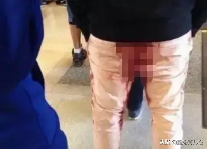 经痛是什么，肋间神经痛是什么（姨妈疼究竟是一种什么样的痛）