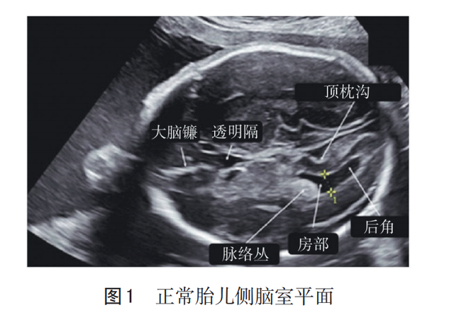 10分钟看懂四维，检查报告的这几点能看懂