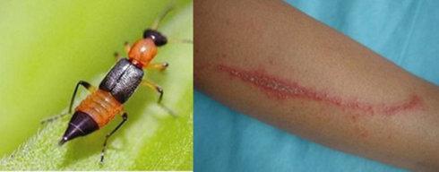 家里有硫酸蚁怎么处理,如何预防硫酸蚁(夏天活动频繁的硫酸蚁)