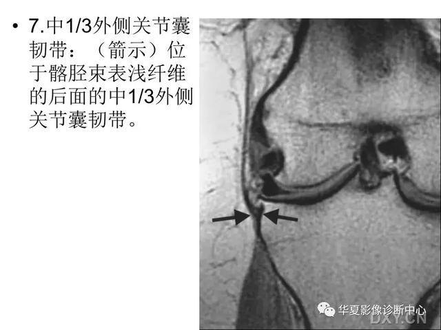 膝关节解剖结构图，膝盖解剖图示意图（膝关节MRI之正常解剖综述）