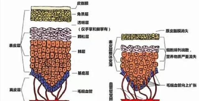 单眼皮比双眼皮有什么好处，单眼皮和双眼皮各有什么好处（小眼睛、单眼皮，听说更耐老）