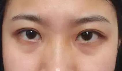 兰蔻眼霜生产日期怎么看生产日期，兰蔻面霜哪里看生产日期（无论你现在20、30还是40岁）