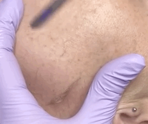 der是什么意思，网络用语der是什么意思（欧美女生迷上了人工磨皮）