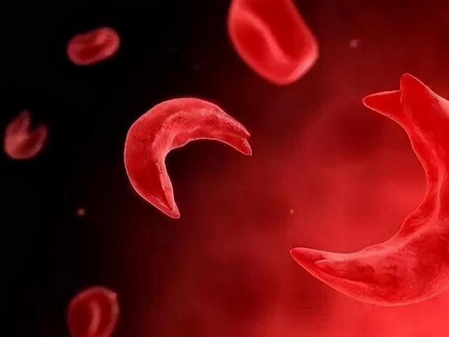 胆红素偏高的原因及危害，胆红素偏高的危害是什么（什么原因会引起胆红素的升高）