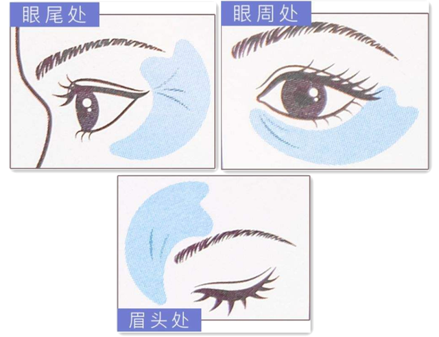 眼袋下面的纹是什么纹，为什么眼睛下面有眼袋纹（你又知道这黑三角是哪吗）