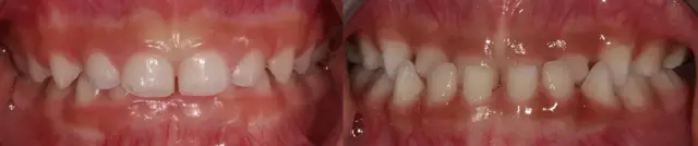 宝宝换奶瓶顺序，小宝宝奶瓶多久换一次（宝宝几岁用水杯）