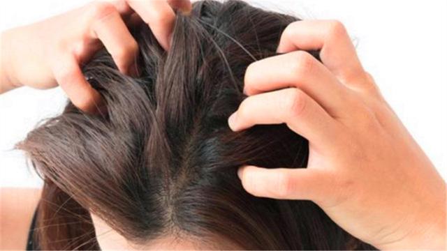 虱子卵长什么样，虱子卵（30年前农村人人都长的虱子）