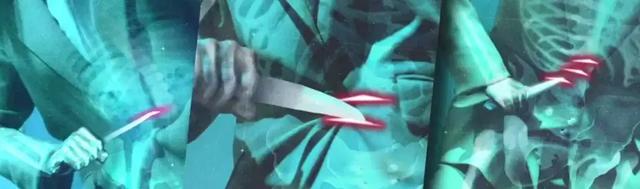 检法男女中张哲医生的扮演者，检法男女张哲谁演的（《检法男女2》第二集和朴有天事件有关）