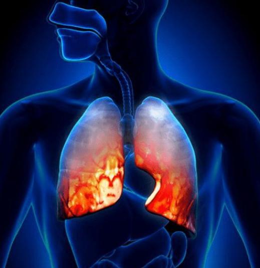 一下子戒烟好吗，戒烟是一下子就戒掉好还是慢慢戒掉比较好（是好事还是坏事呢）