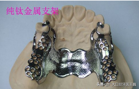 怎么样种牙，怎么样种香菜（目前最先进的活动义齿是哪种）