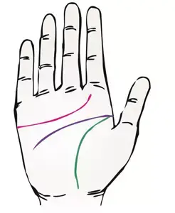 掌纹诊病实用图谱，看看你的掌纹：预示者不同疾病（可以诊断肝癌、糖尿病、高血压、妇科病、脑溢血）