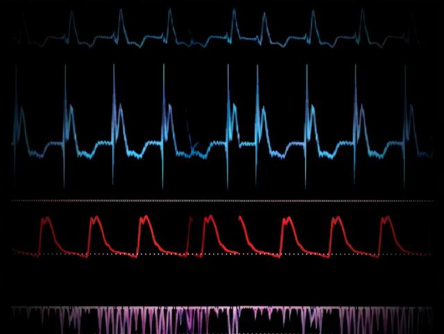 荷叶山楂陈皮泡水喝的功效，荷叶山楂膏喝了有什么功效（高血压病、高血脂症、脂肪肝）