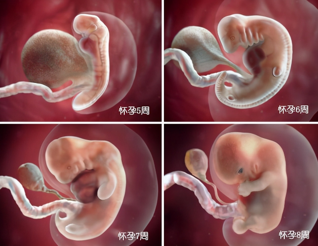 怀孕一个月胎儿图，怀孕一个月胎儿图彩超图片（不同阶段宝宝的发育过程）