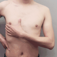 男生胸大怎么减，男生的胸大怎么瘦下来（没想到男性胸大竟然是一种病）