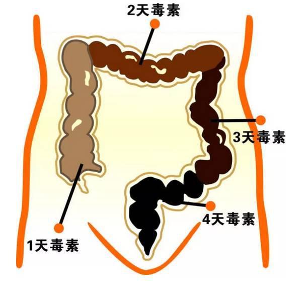 治疗便秘小妙招，治疗便秘的小妙招有哪些（西医教你4个小方法）