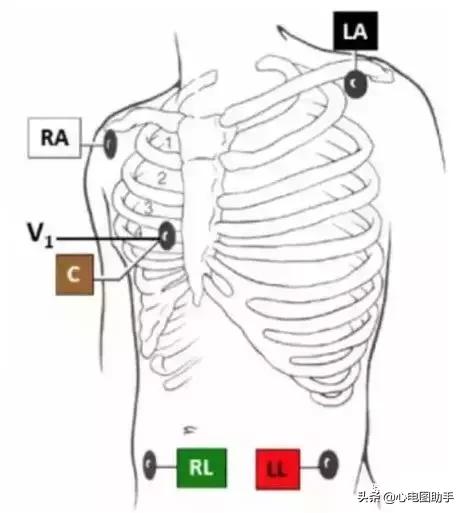 胸骨左缘第五肋间隙下两厘米的地方是她，我把她藏在心跳最剧烈的地方。，你是我放在胸骨左缘第五肋间隙的人（来看看这些需要注意的细节图片）