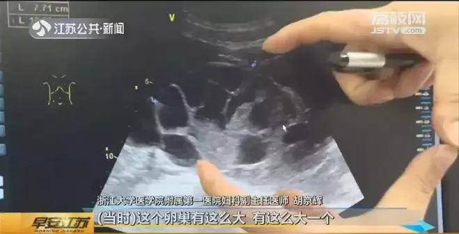 女友竟是学校公厕（女大学生为买iPhone竟然卖卵）