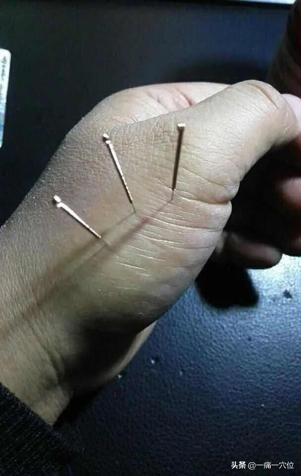 人体胃的位置图，人的胃在身体的左边还是右边，你分的清楚吗（胃病烧心、胃胀、呕吐、反酸大总结）