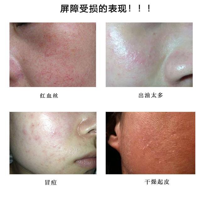 倩碧黄油是什么，倩碧黄油无油（经典黄油我能回购一万年，强推）