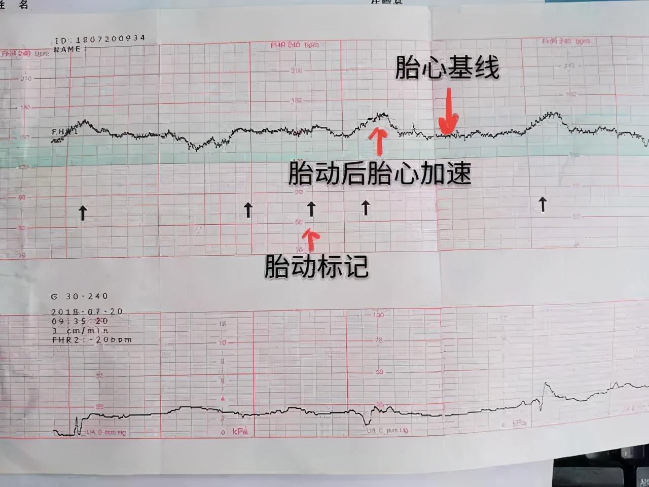 胎儿心跳多少是男孩，胎儿心跳数多少是男孩（胎心率能看出胎儿性别？别傻了）