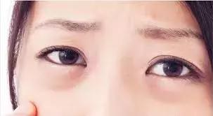 兰蔻眼霜生产日期怎么看生产日期，兰蔻面霜哪里看生产日期（无论你现在20、30还是40岁）