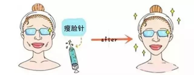 瘦脸针品牌十大排行榜，瘦脸针品牌排行榜（瘦脸针能维持多久）