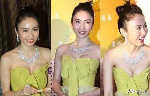 发际线粉会堵塞毛孔吗，发际线粉的危害（关晓彤才23岁就秃了）