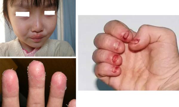 小孩咬指甲是怎么回事(孩子总是) - seo葵花宝典
