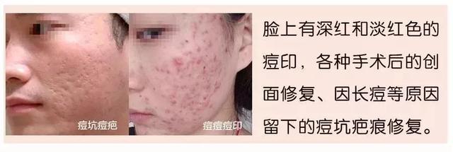 冻干粉用在护肤的哪个步骤，冻干粉免洗面膜效果怎么样（冻干粉是什么，有什么作用）