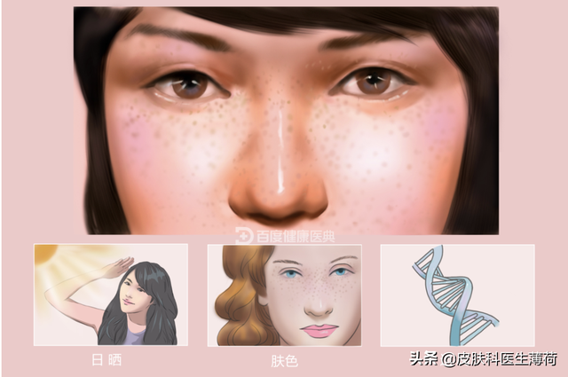 手臂上有咖啡色的斑图片，为何手臂上有很多暗沉的色斑（一文教你辨识自己长的究竟是啥斑）