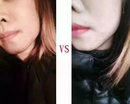 冻干粉用在护肤的哪个步骤，冻干粉免洗面膜效果怎么样（冻干粉是什么，有什么作用）