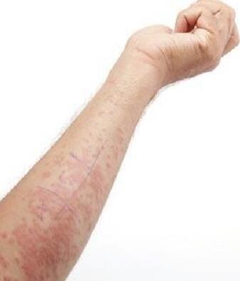 甘草油的作用与功效，甘草油的作用与功效与作用（北京中医医院镇院之宝甘草油）