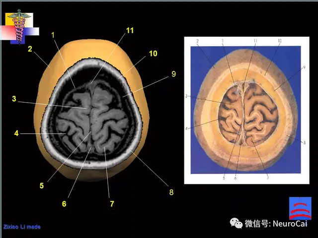 大脑结构图及功能图，人类大脑十大三维解剖图（脑局部解剖与功能图谱）