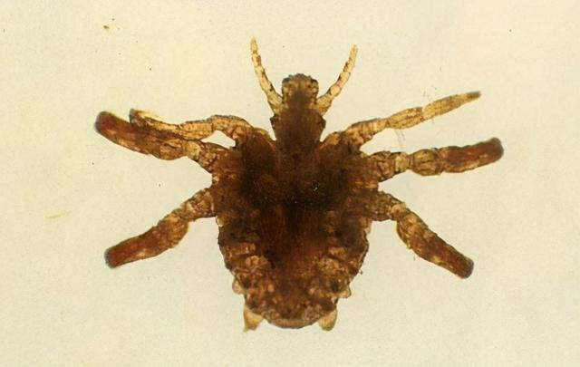 虱子相关介绍，虱子怎么读（30年前男女老少都长虱子）