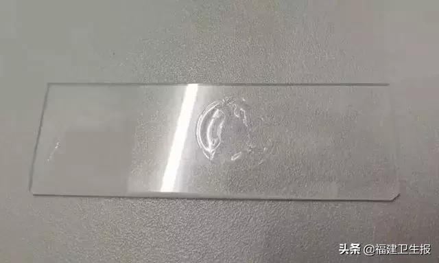 隐形眼镜日抛是什么意思，医生靠显微镜开始“地毯式”搜寻……