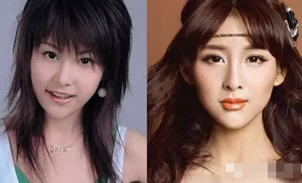 贾青整容，贾青整容前后照片对比（贾青在公路中违规拍照）