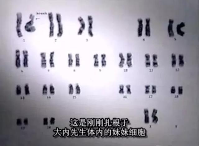 日本东海村核临界事故，日本东海村核临界事故百科（核辐射惨烈堪比十八层地狱）