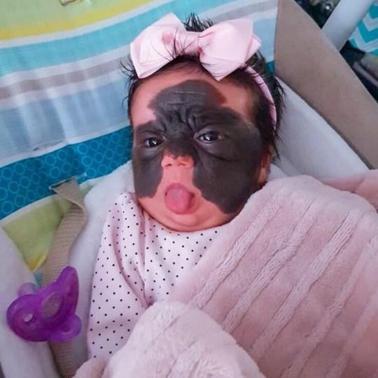 光敏印章怎么加油，原子公章和光敏章的区别（萌娃因“蝙蝠侠”胎记遭网暴）