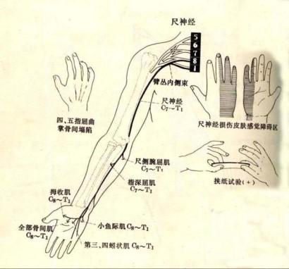 一只手麻一只手不麻，一只手手指头发麻是什么情况（中医推拿师真的能分清吗）