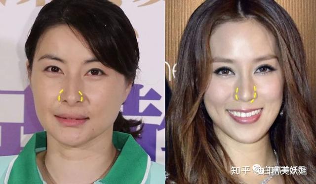 女孩子有灵气的面相，阴德厚重的女人面相（所有豪门阔太都是“郭式旺夫脸”）